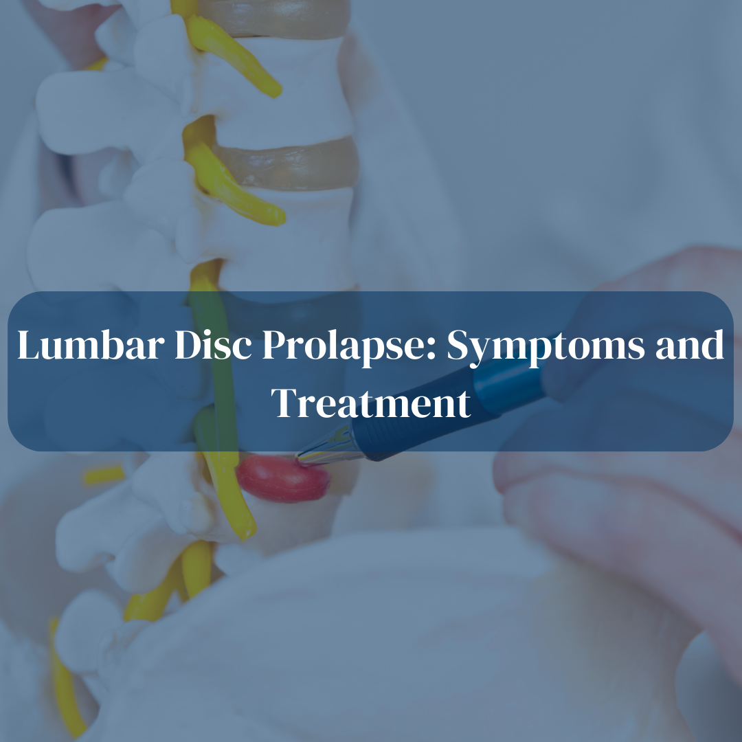 Lumbar Disc Prolapse: Symptoms and Treatment