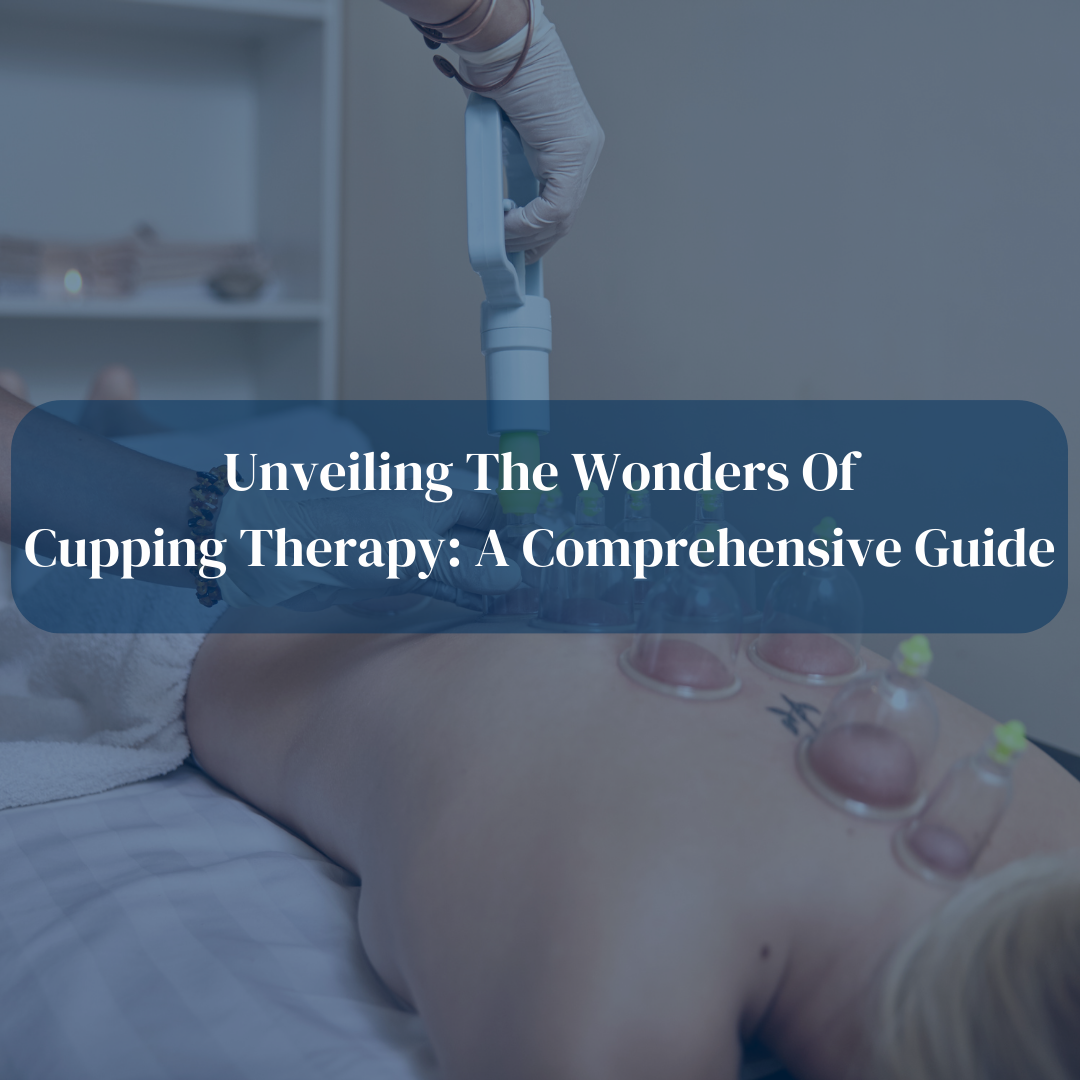Unveiling the Wonders of Cupping Therapy: A Comprehensive Guide