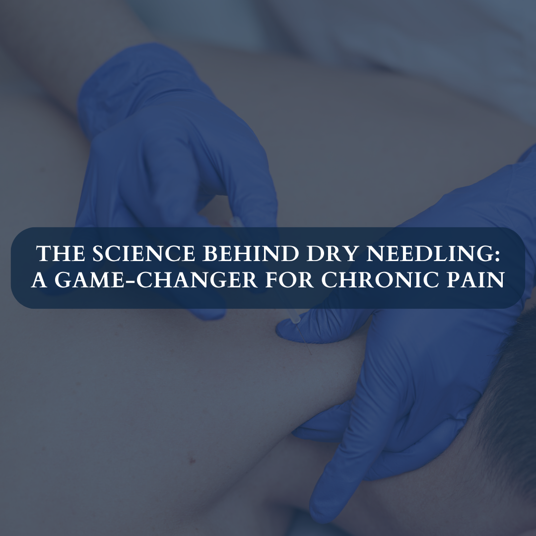 The Science Behind Dry Needling: A Game-Changer for Chronic Pain
