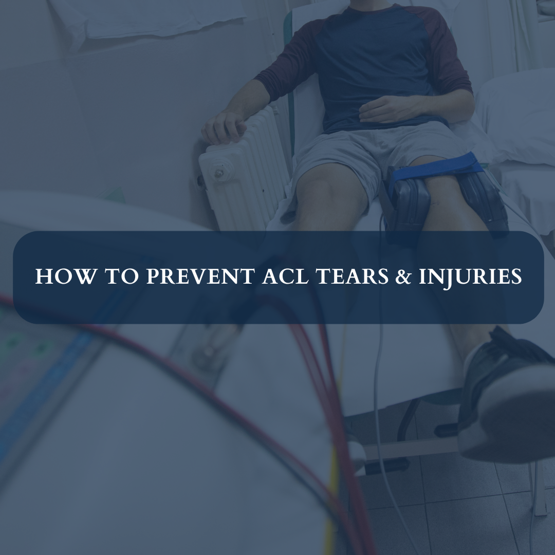 How to Prevent ACL Tears & Injuries