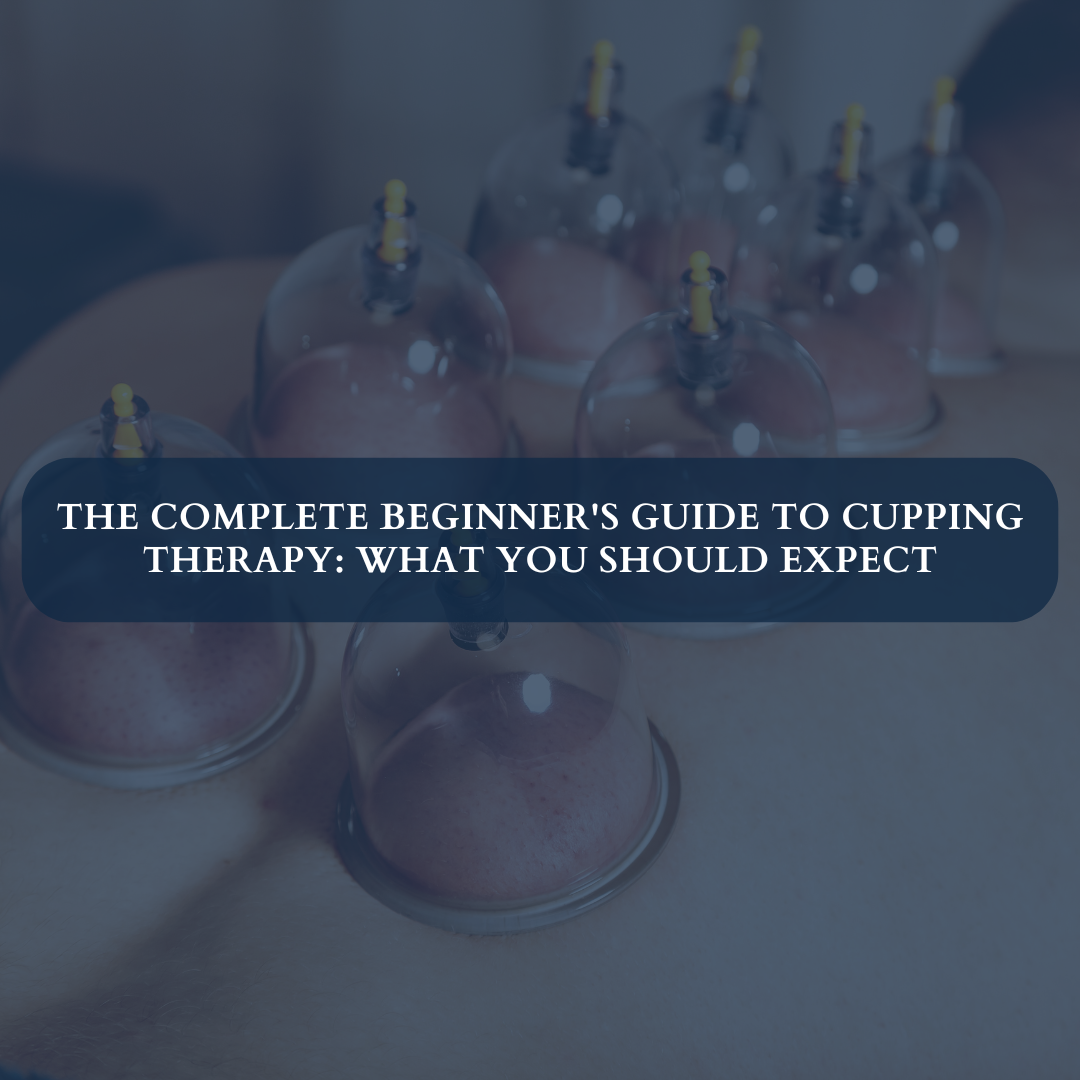 The Complete Beginner’s Guide to Cupping Therapy: What You Should Expect