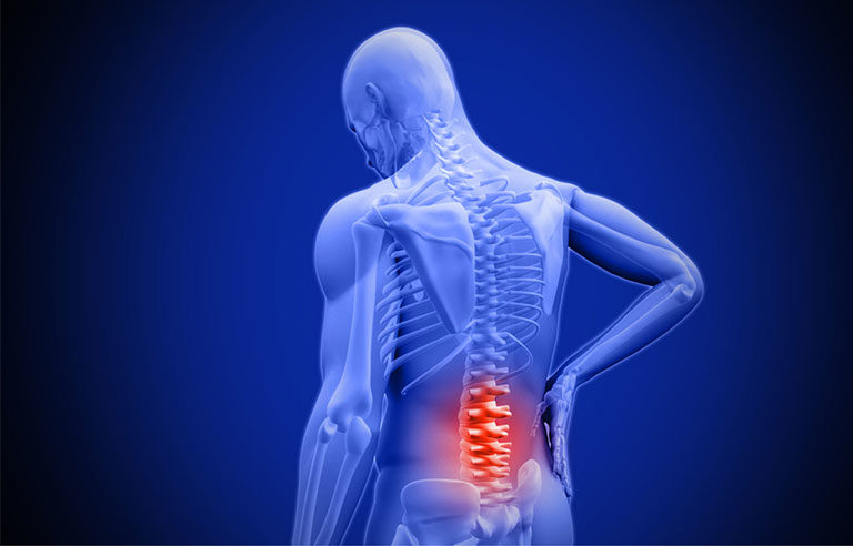 Chronic Back Pain