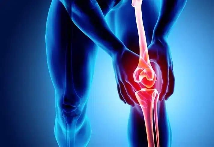 Managing Knee Pain: Understanding Osteophytic Changes and the Role of Physiotherapy