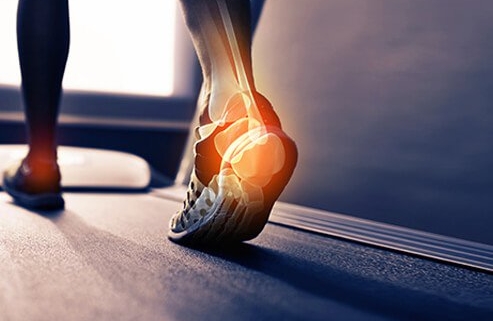 How to Prevent Common Sports Injuries