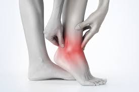 How to Reduce Ankle Pain: A Comprehensive Guide to Relief and Recovery