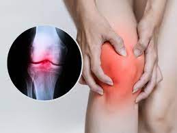 how to prevent arthritis