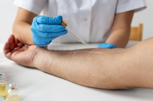 how effective is dry needling for tennis elbow