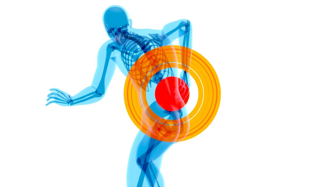 what causes sciatica pain