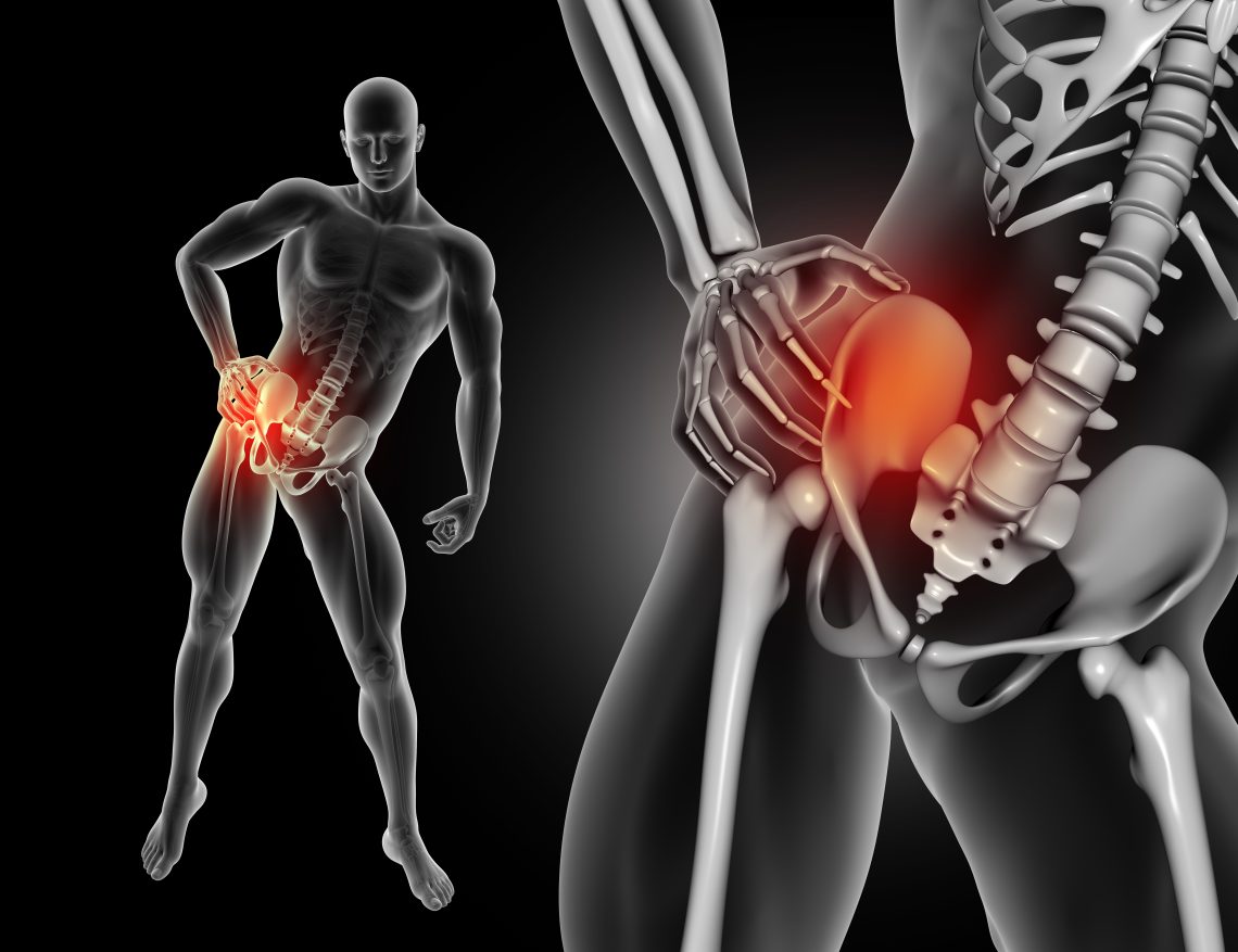 how to rid of sciatica pain