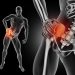 how to rid of sciatica pain