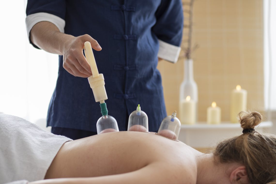 does cupping therapy work for weight loss