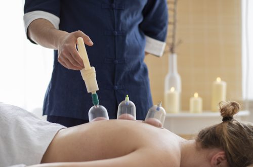 does cupping therapy work for weight loss