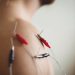does dry needling increase blood flow