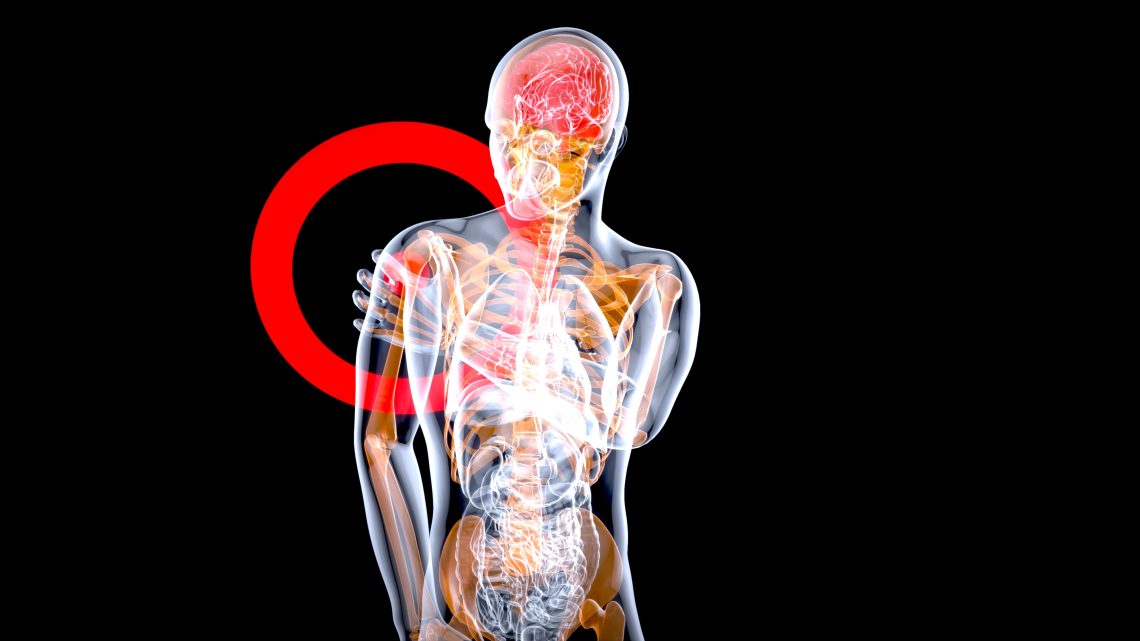 how to release myofacsial trigger points