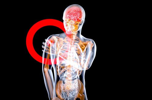 how to release myofacsial trigger points