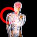how to release myofacsial trigger points
