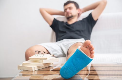 how to recover from a sprained ankle