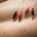 is acupuncture and dry needling the same